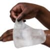 Brandwondenkompres Burnshield Voorbeeld Op Hand
